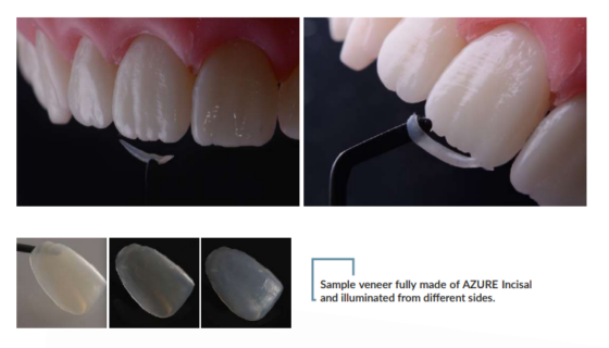 Azure Incisial - Azure Incisial olident maxilo dental ZUBY 2